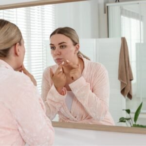 Acne Care Playbook (E-Book)